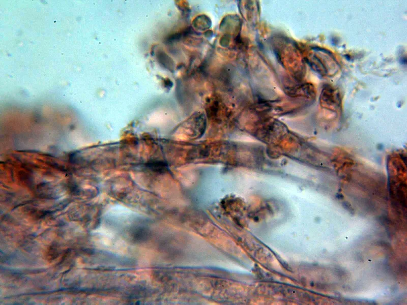 Ampulloclitocybe clavipes 7 - Suprapellis 1